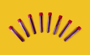 Test tubes containing a blood test sampless