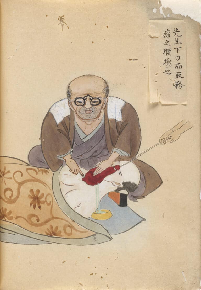 Image from Surgical Casebook by Hanaoka Seishu